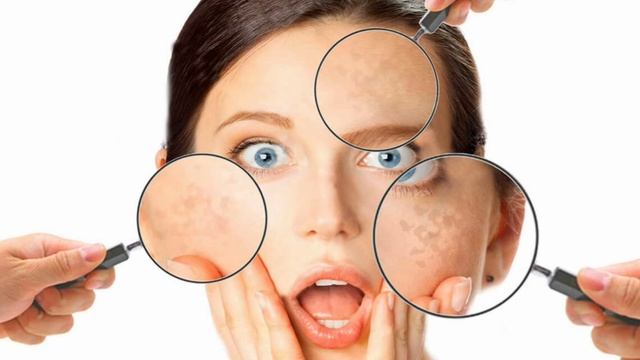 Повышенная пигментация кожи!Это значит,пришло время заняться очисткой печени! смотреть онлайн