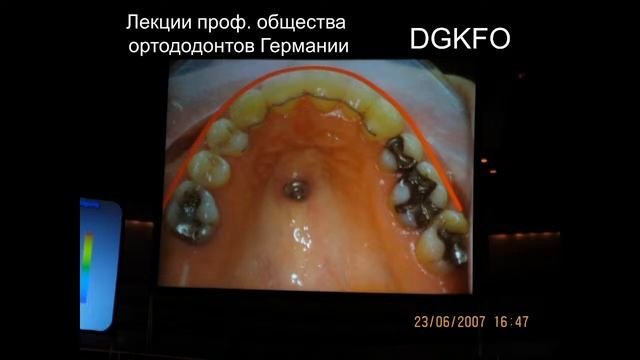 Организация ортодонтической помощи населению.