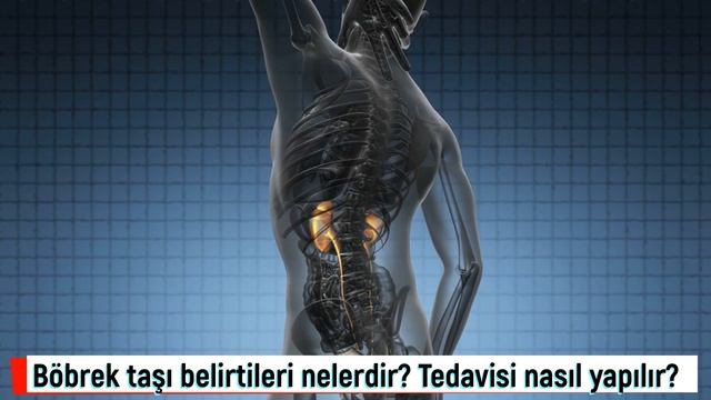 Böbrek taşı belirtileri nelerdir? Böbrek taşı tedavisi nasıl yapılır? Böbrek taşı nedir? смотреть онлайн