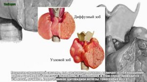 Причины задержки месячных  если отсутствует беременность