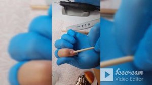 М.К. Наращивание на нижние формы (арочный квадрат)