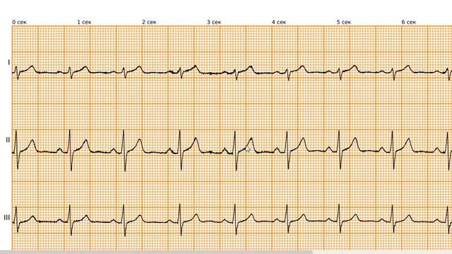 Запис 2020 02 09 07 23 19 215 смотреть онлайн