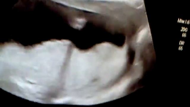 Andrew bennett смотреть онлайн