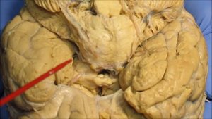 Основание мозга. Продолговатый мозг. Задний мозг, мост, мозжечок