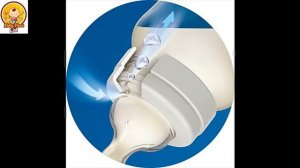 Philips Avent Anti colic Baby Bottles Clear Review