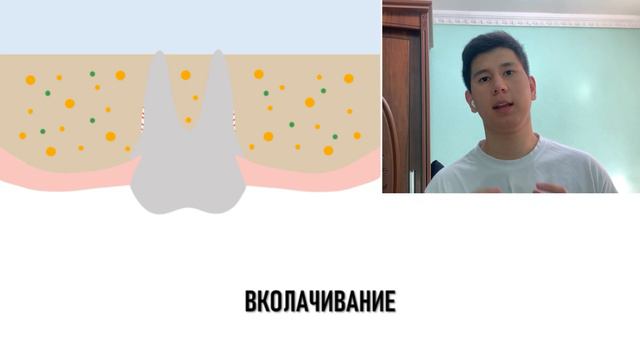 ОРТОДОНТИЧЕСКИЙ СЛОВАРЬ | ЧАСТЬ 2 #orthodontist #tashkent #youtube смотреть онлайн