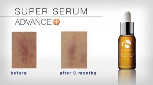 SUPER SERUM ADVANCE+