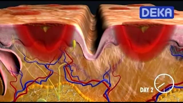 Лазерное омоложение DOT.flv смотреть онлайн