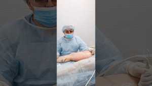 Процедура ЭВЛК, комбинированная с мини-флебэктомией и склеротерапией (Нина)