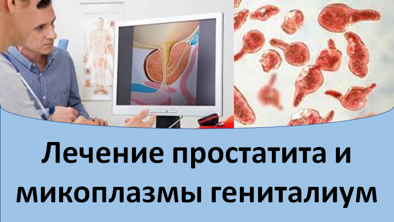 Лечение простатита и микоплазмы гениталиум.