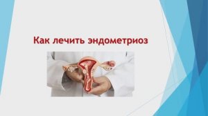 как лечить эндометриоз