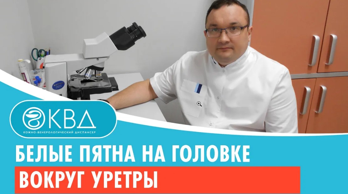 ? Белые пятна на головке вокруг уретры. Клинический случай №592