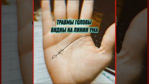 Травмы головы видны на линии Ума