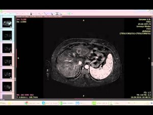 Как отправлять DICOM исследование