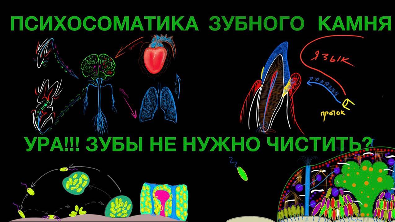 Психосоматика зубного камня - решение внутреннего конфликта путем чистки зубов