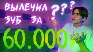 ВЫЛЕЧИЛ ЗУБ ЗА 60.000₽ ?! | ИСТОРИЯ ПРО СТОМАТОЛОГИЮ