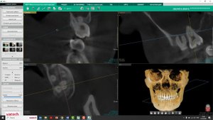Протокол оценки КЛКТ для эндодонтистов