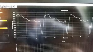 Сравнение ШИМ Samsung Galaxy Note 20 ultra и Galaxy Note 9