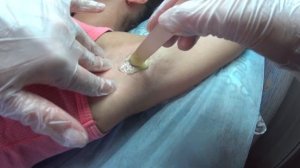 ШУГАРИНГ / ПОДМЫШЕЧНЫЕ ВПАДИНЫ В ШПАТЕЛЬНОЙ ТЕХНИКЕ / РАЗБОР ОШИБОК  / В ЧЕМ ПРЕИМУЩЕСТВО