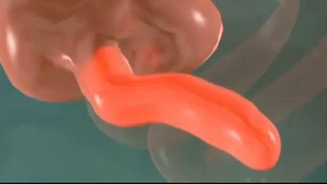 Аппендицит смотреть онлайн