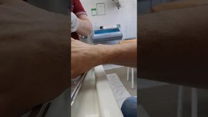 4я перевязка перелома мизинца (17.04.21)