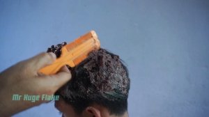 Psoriasis Treatment | Dandruff Scratching ASMR (85)