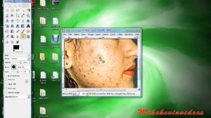 How To Fix Acne in Gimp Or Photoshop