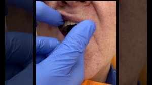 Протезирование