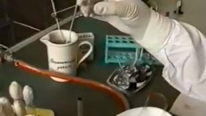 8 Методика виявлення капсул за методом Бурри Гінса