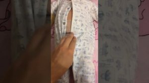 Как убрать пупочную грыжу