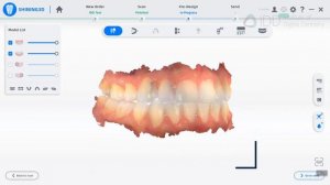 Shining 3D Aoralscan 3 Review - Software and Apps