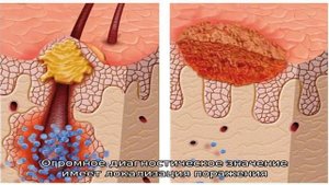 Дерматит у собак – причины возникновения и методы лечения