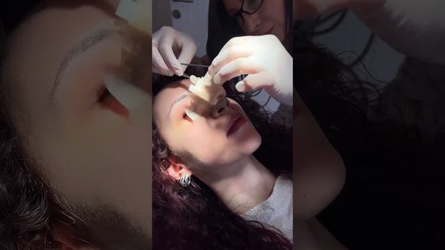 Burun Estetiği Ameliyatları смотреть онлайн