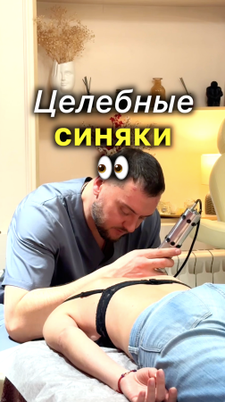 Целебные Синяки ??