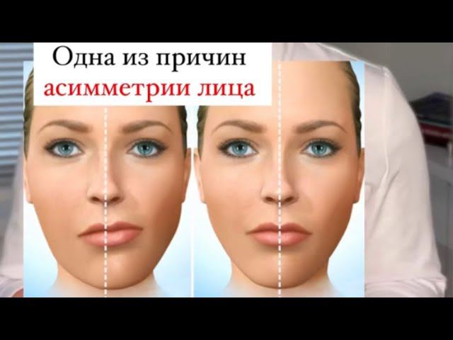 Именно эта мышца дает самое большое напряжение в челюсти и участвует в формировании асимметрии лица.