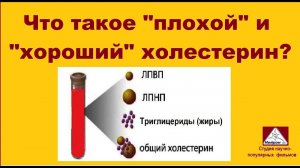 Что такое плохой и хороший холестерин?