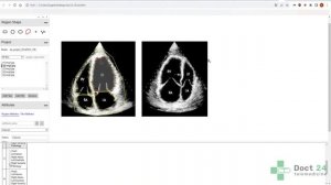 Разметка изображений с помощью VGG Image Annotator (VIA)