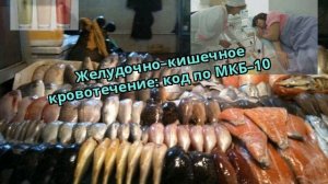 Желудочно–кишечное кровотечение: код по МКБ–10