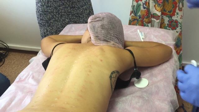 1 июля 2017 г.Мезотерапия смотреть онлайн