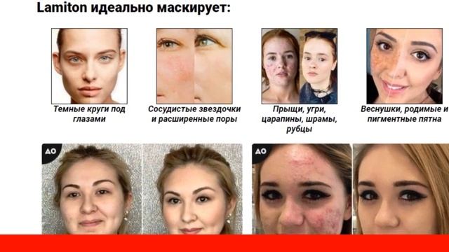 Ламитон тональный крем цена смотреть онлайн