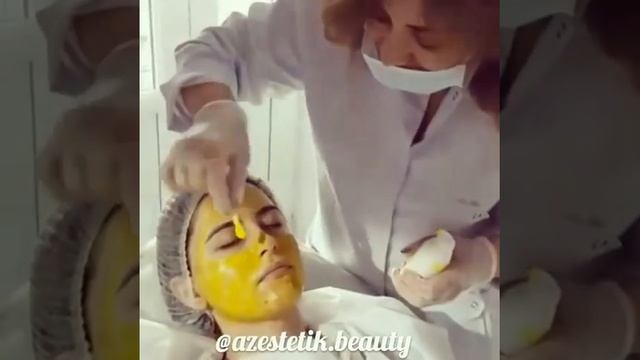 Sarı pilinq, Baki. Желтый пилинг, Баку. смотреть онлайн