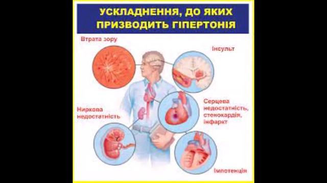 Лев. Четвёртый знак Зодиака. Второй огненный знак. Характеристики Льва. Еда Льва. Страны под Львом.