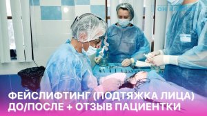 Фейслифтинг (подтяжка лица) в ОН КЛИНИК. Ход операции. До / после. Отзыв пациентки.