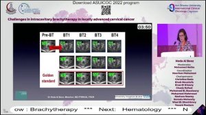 ASUICOC 2022 - Day 2 - Hall B - Session 38 Brachytherapy