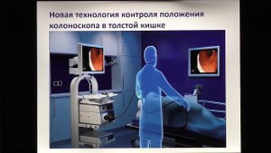 07 Кашин СВ Техника проведения колоноскопии Проведение колоноскопа до купола слепой кишки