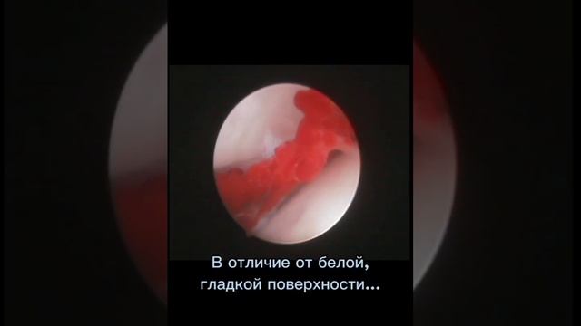 Дисплазия локтя | Ветеринарная клиника "Добрый Доктор Воронеж" смотреть онлайн