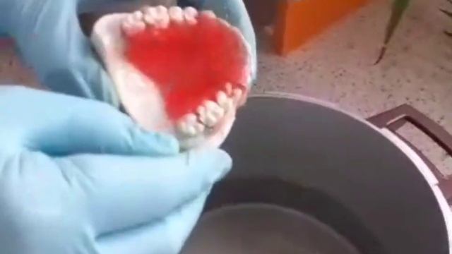 Способы изготовления ортодонтических аппаратов смотреть онлайн