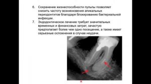 Эндодонтия 2. АФО пульпы зуба. Диагностика в эндодонтии