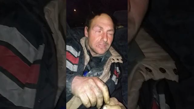 Мужик обморозил пальцы смотреть онлайн