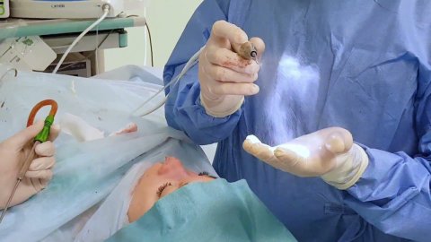 Ринопластика - пластика носа